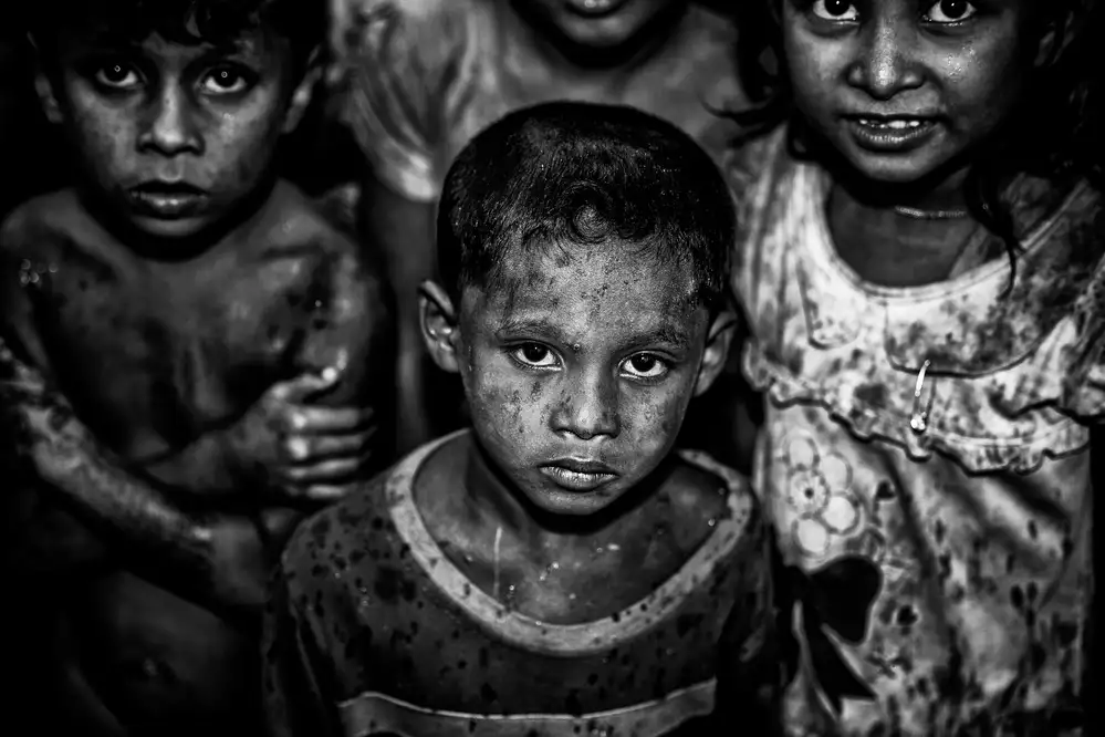 Garmendia, Inazio Joxe: Niños rohingya bajo la lluvia.