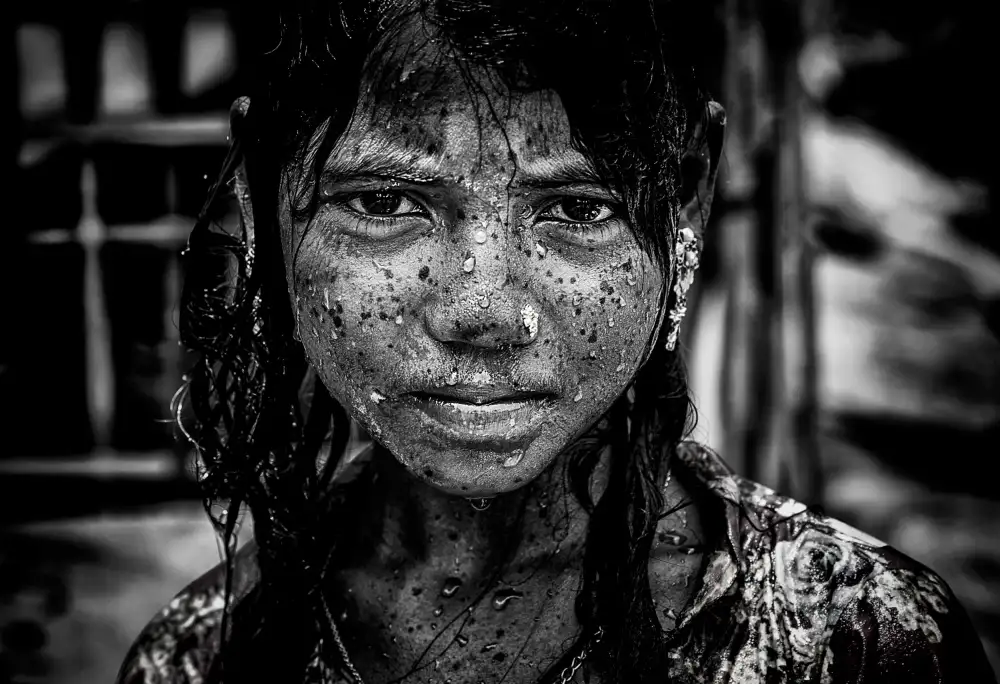 Garmendia, Inazio Joxe: Niña refugiada rohingya refrescándose del calor - Bangladesh