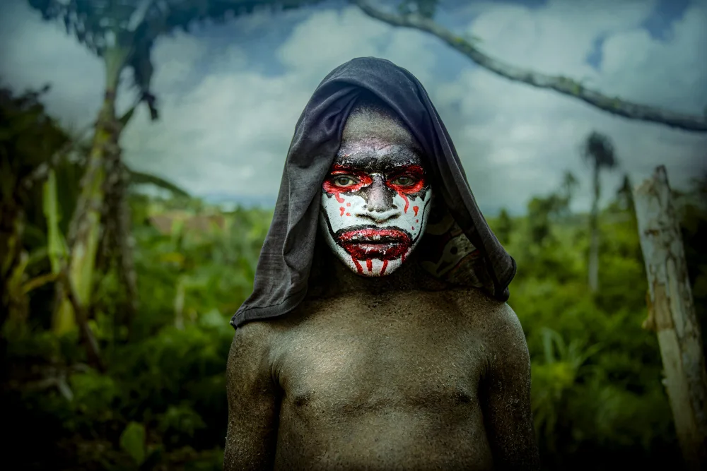 Yosifov, Svetlin: Boy from the Wayna Suanda tribe with a skin disease., Papua New Guinea