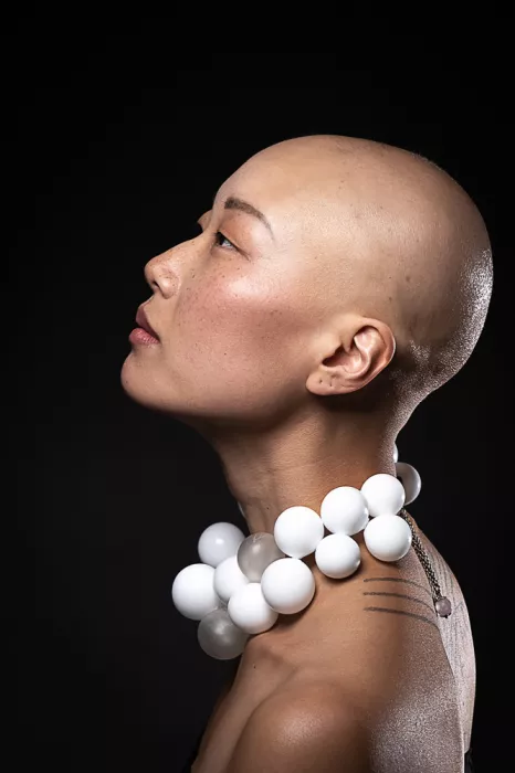 MATTY, TOV MAZAL: Bald is beautiful