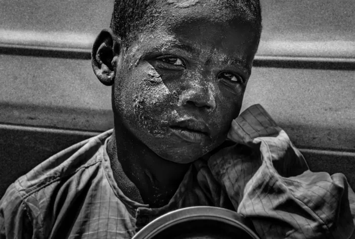 Garmendia, Inazio Joxe: Kind um Hilfe bittend auf den Straßen des Kongo
