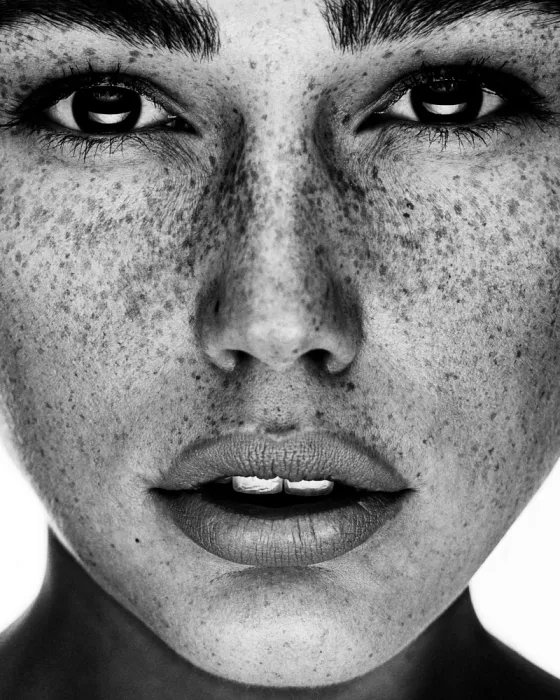 Krystynek, Martin: Belleza con pecas