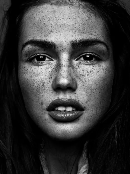 Krystynek, Martin: Belleza con pecas