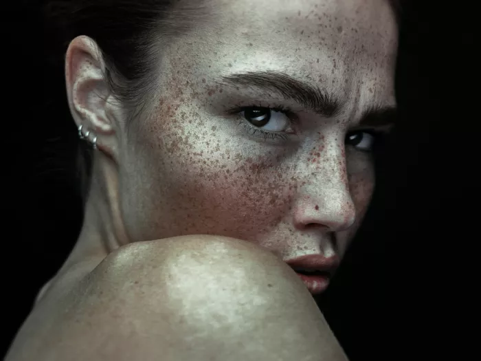 Krystynek, Martin: Belleza con pecas