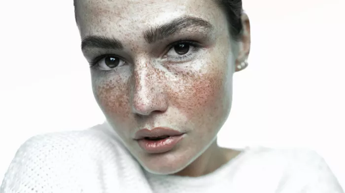 Krystynek, Martin: Belleza con pecas